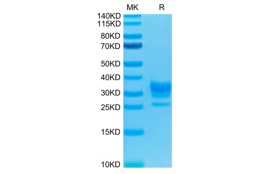 Tris-Bis PAGE - Recombinant Human CD32 Protein (Biotin) (C-terminal His and Avi Tag) (A330319) - Antibodies.com
