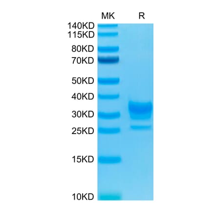 Tris-Bis PAGE - Recombinant Human CD32 Protein (Biotin) (C-terminal His and Avi Tag) (A330319) - Antibodies.com