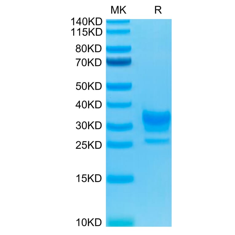 Tris-Bis PAGE - Recombinant Human CD32 Protein (Biotin) (C-terminal His and Avi Tag) (A330319) - Antibodies.com