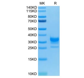 Tris-Bis PAGE - Recombinant Human CD32 Protein (C-terminal His and Avi Tag) (A330320) - Antibodies.com