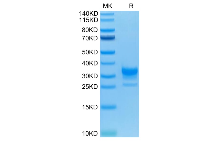Tris-Bis PAGE - Recombinant Human CD32 Protein (C-terminal His and Avi Tag) (A330320) - Antibodies.com