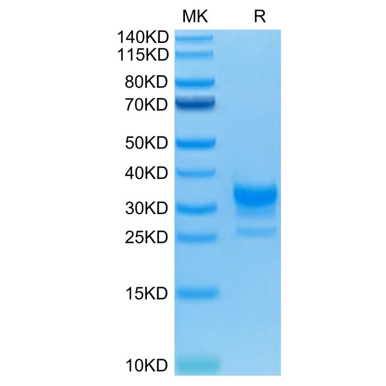 Tris-Bis PAGE - Recombinant Human CD32 Protein (C-terminal His and Avi Tag) (A330320) - Antibodies.com