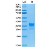 Tris-Bis PAGE - Recombinant Human CD32 Protein (C-terminal His and Avi Tag) (A330320) - Antibodies.com