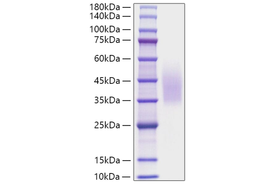 SDS-PAGE - Recombinant Human CD320 Protein (C-terminal His Tag) (A330321) - Antibodies.com