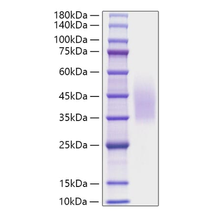 SDS-PAGE - Recombinant Human CD320 Protein (C-terminal His Tag) (A330321) - Antibodies.com