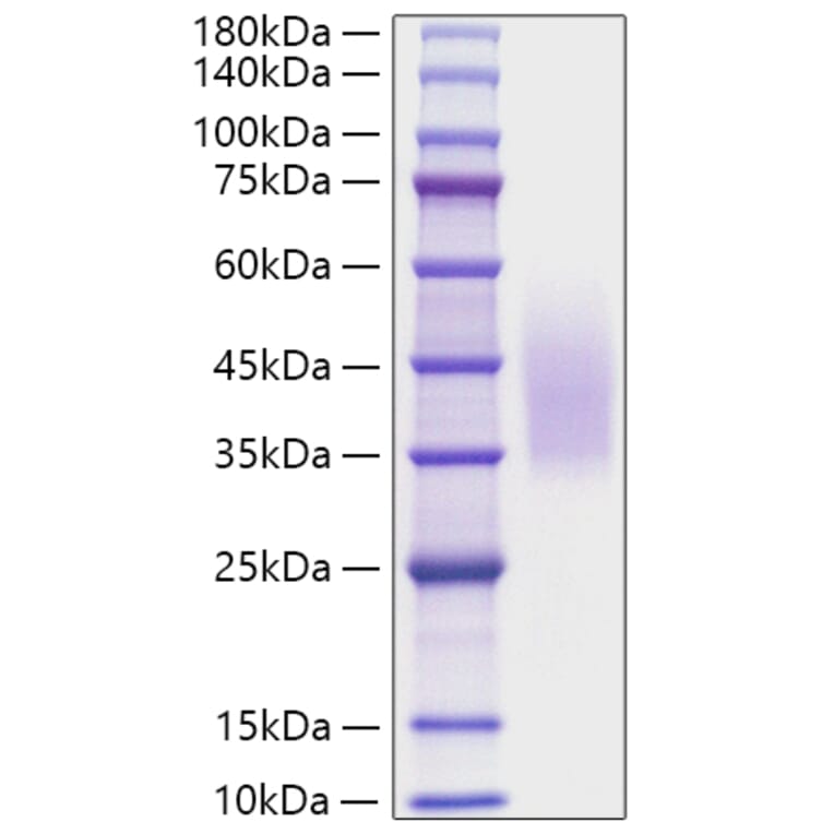 SDS-PAGE - Recombinant Human CD320 Protein (C-terminal His Tag) (A330321) - Antibodies.com