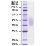 SDS-PAGE - Recombinant Human CD320 Protein (C-terminal His Tag) (A330321) - Antibodies.com