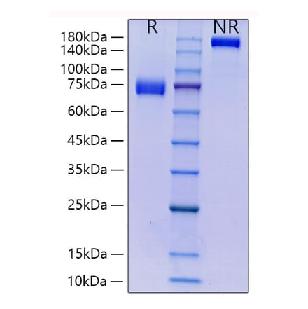 SDS-PAGE - Recombinant Human CD33 Protein (C-terminal Human Fc and His Tag) (A330322) - Antibodies.com