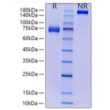 SDS-PAGE - Recombinant Human CD33 Protein (C-terminal Human Fc and His Tag) (A330322) - Antibodies.com