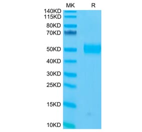 Tris-Bis PAGE - Recombinant Human CD33 Protein (C-terminal His and Avi Tag) (A330323) - Antibodies.com