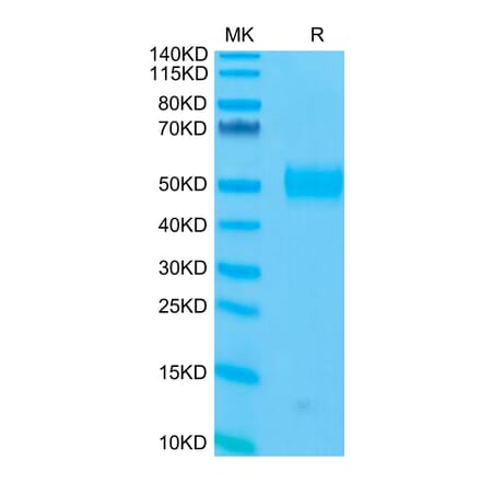 Tris-Bis PAGE - Recombinant Human CD33 Protein (C-terminal His and Avi Tag) (A330323) - Antibodies.com