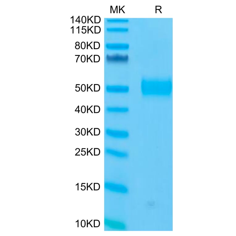Tris-Bis PAGE - Recombinant Human CD33 Protein (C-terminal His and Avi Tag) (A330323) - Antibodies.com