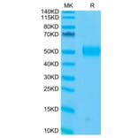 Tris-Bis PAGE - Recombinant Human CD33 Protein (C-terminal His and Avi Tag) (A330323) - Antibodies.com