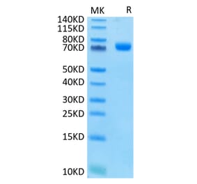 Tris-Bis PAGE - Recombinant Human CD33 Protein (C-terminal Human Fc Tag) (A330324) - Antibodies.com