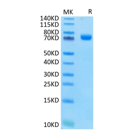 Tris-Bis PAGE - Recombinant Human CD33 Protein (C-terminal Human Fc Tag) (A330324) - Antibodies.com