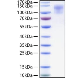 SDS-PAGE - Recombinant Human CD34 Protein (C-terminal Human Fc and His Tag) (A330325) - Antibodies.com