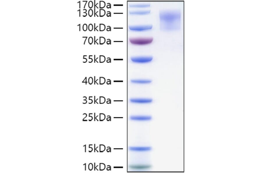 SDS-PAGE - Recombinant Human CD34 Protein (C-terminal Human Fc and His Tag) (A330325) - Antibodies.com