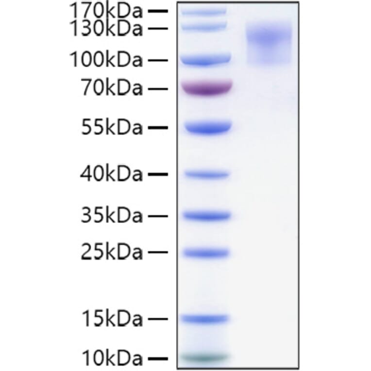 SDS-PAGE - Recombinant Human CD34 Protein (C-terminal Human Fc and His Tag) (A330325) - Antibodies.com