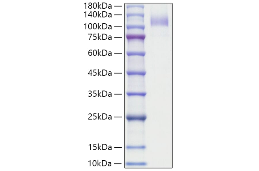 SDS-PAGE - Recombinant Human CD36 Protein (N-terminal Human Fc Tag) (A330326) - Antibodies.com