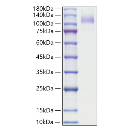 SDS-PAGE - Recombinant Human CD36 Protein (N-terminal Human Fc Tag) (A330326) - Antibodies.com