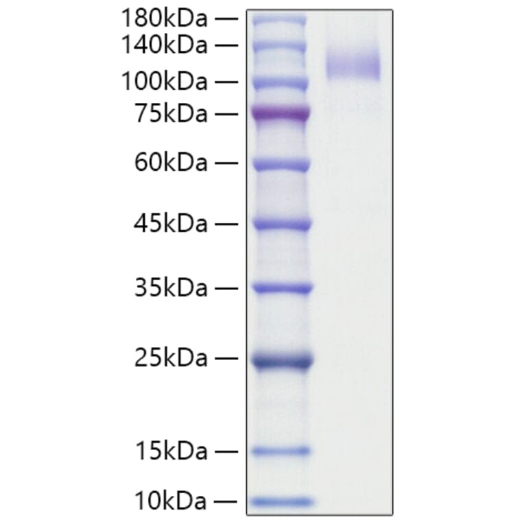 SDS-PAGE - Recombinant Human CD36 Protein (N-terminal Human Fc Tag) (A330326) - Antibodies.com
