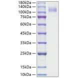 SDS-PAGE - Recombinant Human CD36 Protein (N-terminal Human Fc Tag) (A330326) - Antibodies.com