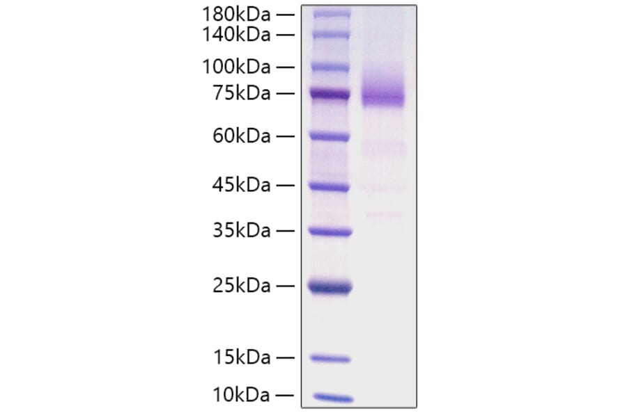 SDS-PAGE - Recombinant Human CD36 Protein (C-terminal His Tag) (A330327) - Antibodies.com