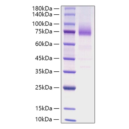 SDS-PAGE - Recombinant Human CD36 Protein (C-terminal His Tag) (A330327) - Antibodies.com