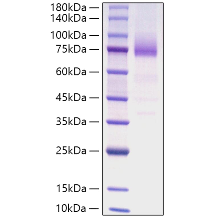 SDS-PAGE - Recombinant Human CD36 Protein (C-terminal His Tag) (A330327) - Antibodies.com