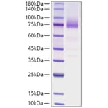 SDS-PAGE - Recombinant Human CD36 Protein (C-terminal His Tag) (A330327) - Antibodies.com