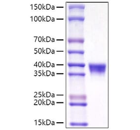 SDS-PAGE - Recombinant Mouse CD38 Protein (C-terminal His Tag) (A330328) - Antibodies.com