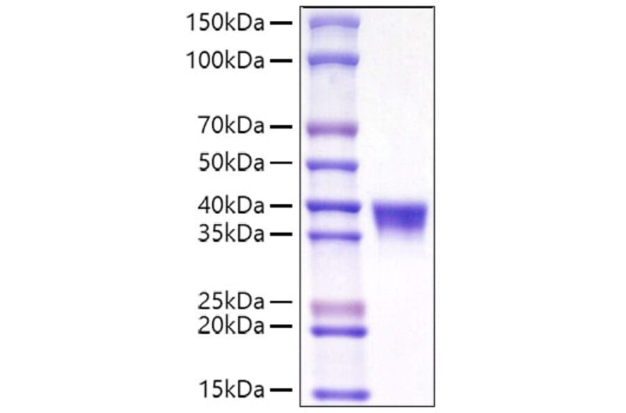 SDS-PAGE - Recombinant Mouse CD38 Protein (C-terminal His Tag) (A330328) - Antibodies.com