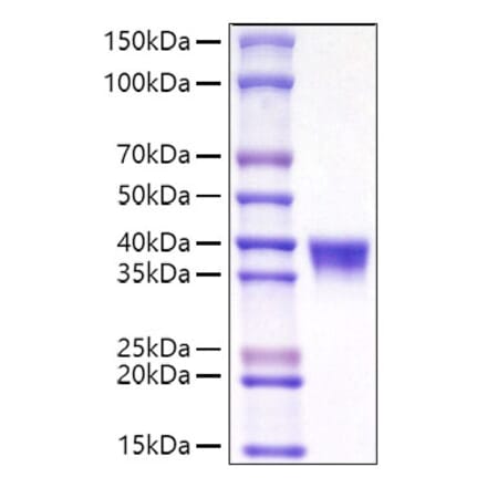 SDS-PAGE - Recombinant Mouse CD38 Protein (C-terminal His Tag) (A330328) - Antibodies.com