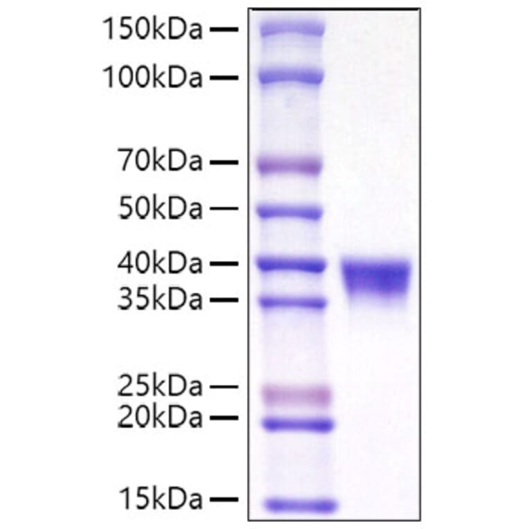 SDS-PAGE - Recombinant Mouse CD38 Protein (C-terminal His Tag) (A330328) - Antibodies.com