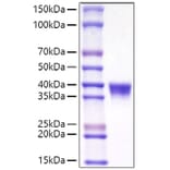 SDS-PAGE - Recombinant Mouse CD38 Protein (C-terminal His Tag) (A330328) - Antibodies.com