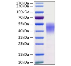 SDS-PAGE - Recombinant Human CD38 Protein (C-terminal His Tag) (A330329) - Antibodies.com