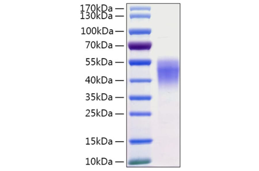 SDS-PAGE - Recombinant Human CD38 Protein (C-terminal His Tag) (A330329) - Antibodies.com