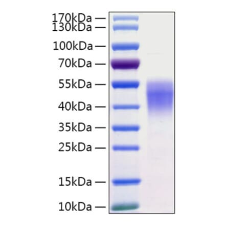 SDS-PAGE - Recombinant Human CD38 Protein (C-terminal His Tag) (A330329) - Antibodies.com