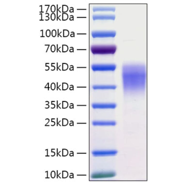 SDS-PAGE - Recombinant Human CD38 Protein (C-terminal His Tag) (A330329) - Antibodies.com