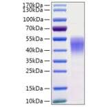 SDS-PAGE - Recombinant Human CD38 Protein (C-terminal His Tag) (A330329) - Antibodies.com