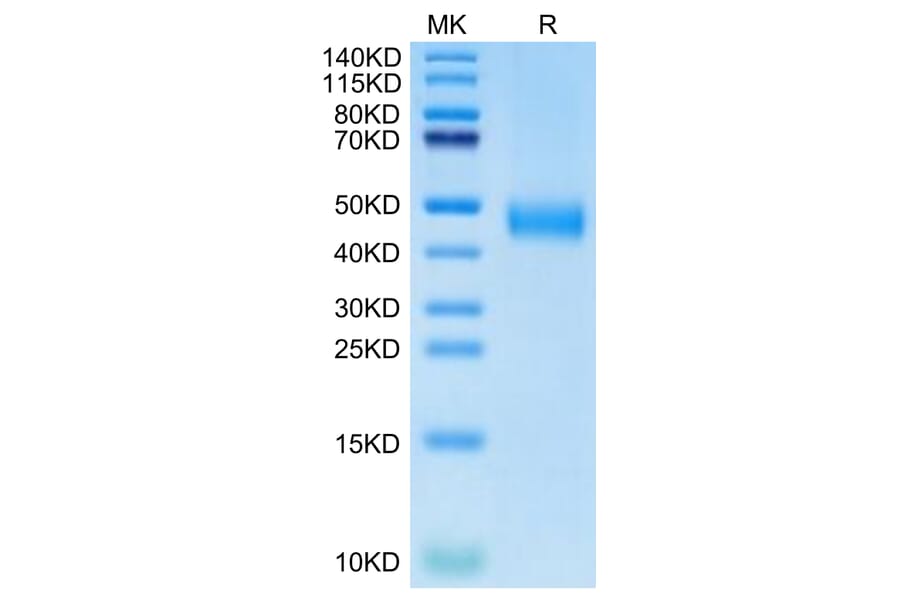 Tris-Bis PAGE - Recombinant Human CD38 Protein (Biotin) (C-terminal His and Avi Tag) (A330330) - Antibodies.com