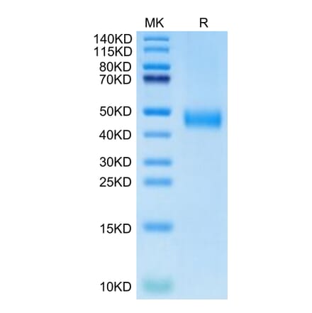 Tris-Bis PAGE - Recombinant Human CD38 Protein (Biotin) (C-terminal His and Avi Tag) (A330330) - Antibodies.com