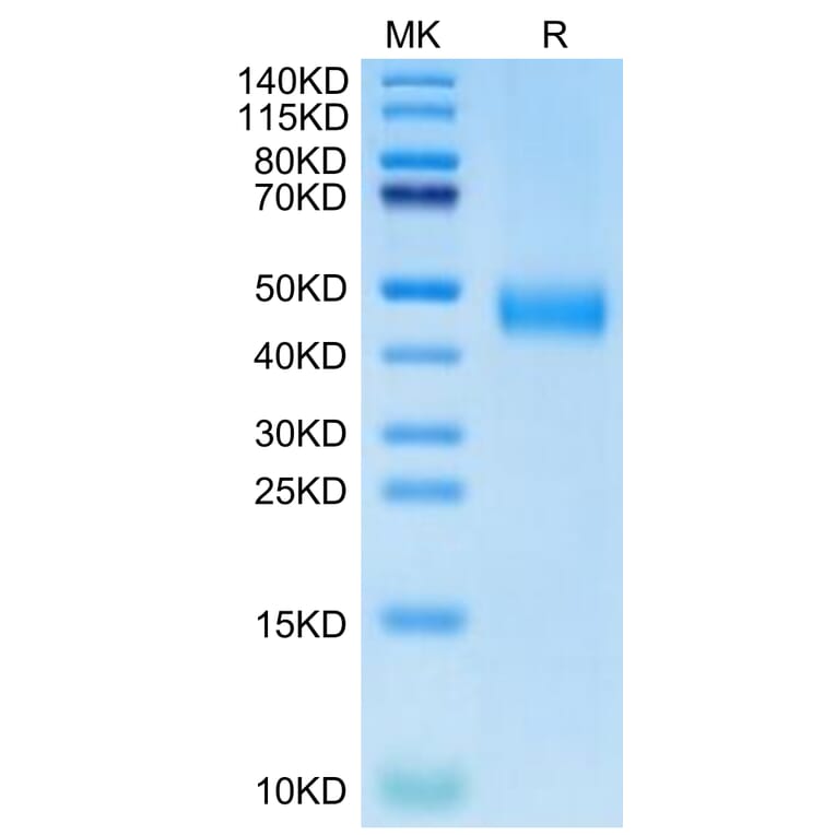 Tris-Bis PAGE - Recombinant Human CD38 Protein (Biotin) (C-terminal His and Avi Tag) (A330330) - Antibodies.com