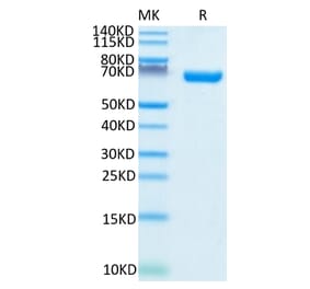 Tris-Bis PAGE - Recombinant Human CD38 Protein (C-terminal Human Fc Tag) (A330331) - Antibodies.com