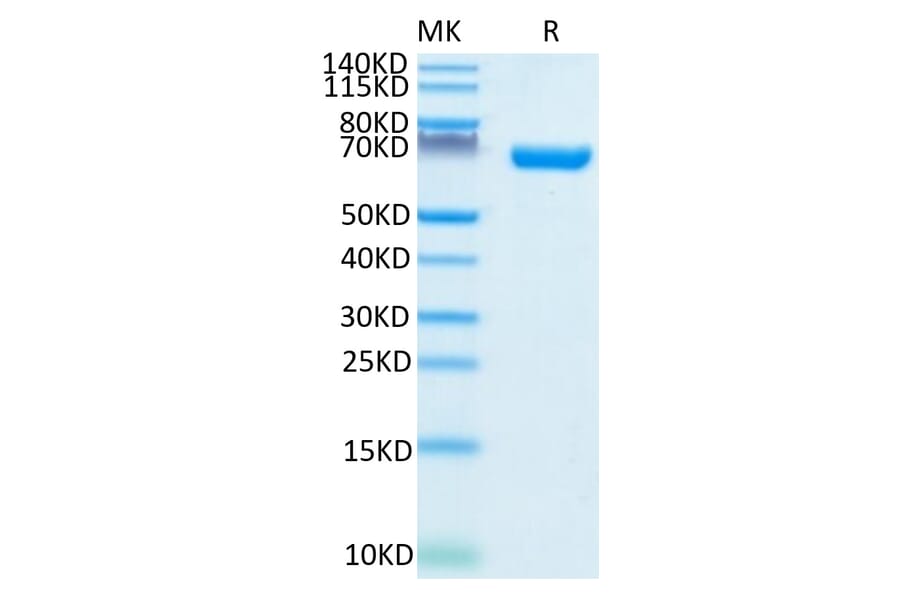 Tris-Bis PAGE - Recombinant Human CD38 Protein (C-terminal Human Fc Tag) (A330331) - Antibodies.com