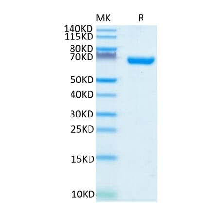 Tris-Bis PAGE - Recombinant Human CD38 Protein (C-terminal Human Fc Tag) (A330331) - Antibodies.com