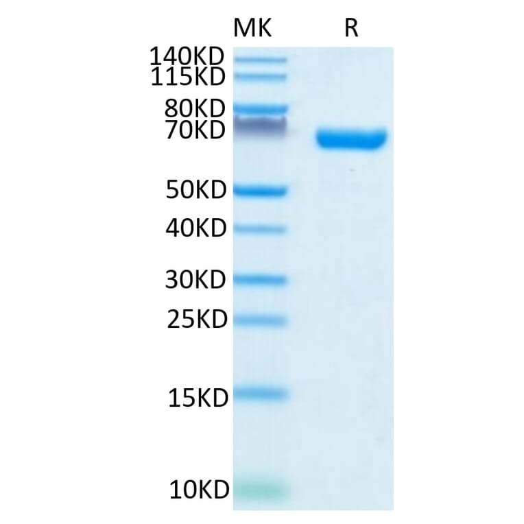 Tris-Bis PAGE - Recombinant Human CD38 Protein (C-terminal Human Fc Tag) (A330331) - Antibodies.com