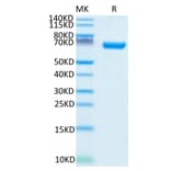 Tris-Bis PAGE - Recombinant Human CD38 Protein (C-terminal Human Fc Tag) (A330331) - Antibodies.com