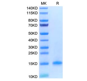 Tris-Bis PAGE - Recombinant Human CD3d Protein (C-terminal His Tag) (A330332) - Antibodies.com