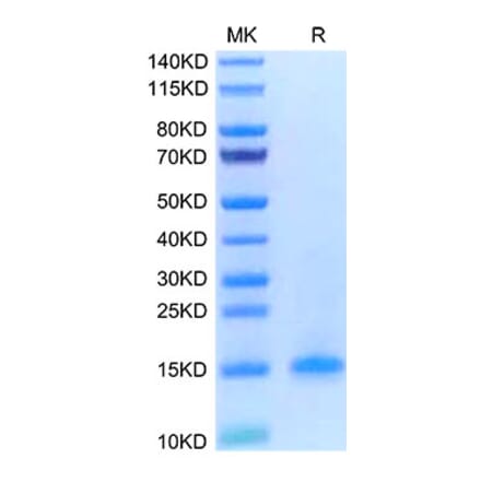Tris-Bis PAGE - Recombinant Human CD3d Protein (C-terminal His Tag) (A330332) - Antibodies.com